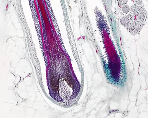 test-epigenetica-salut-pni-maresme