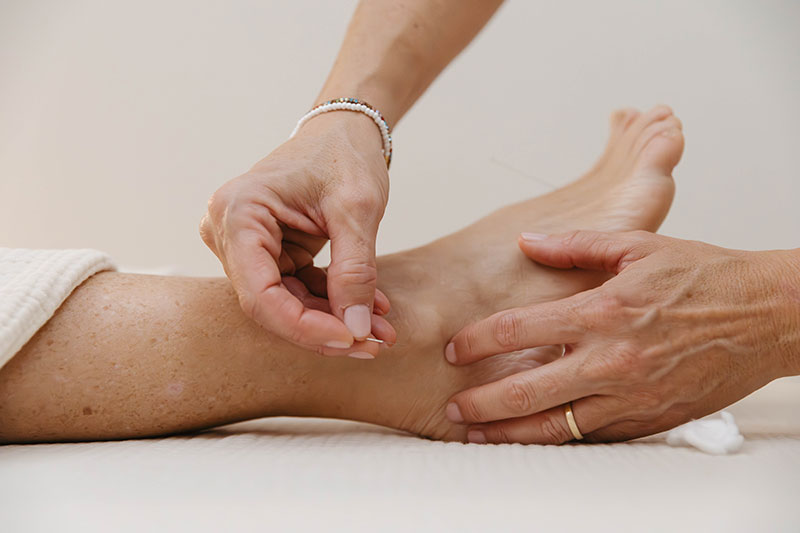 Acupuntura-integrativa